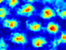 MRI image