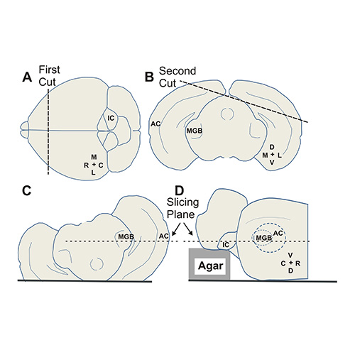 thalamic reticular nucleus slicing