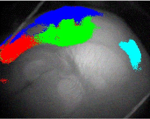 Brain Hearing Imaging
