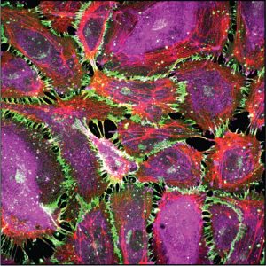 Mechanotransduction