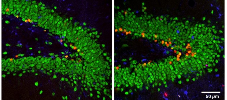 Neurogenesis