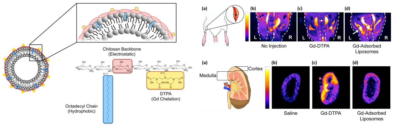 (Left) Scheme of liposome particles coated with gadolinium using a chitosan fastener; (Right) MR images of two animal models with injection of Gd-coated liposomes.