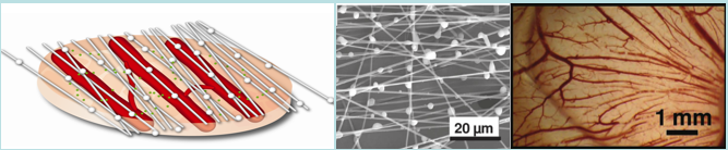 Proangiogenic fiber/microparticle patch assembled through in situ electrospinning and electrospraying