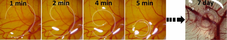 In situ self-folding of a PEGDA hydrogel at an implantation site