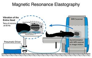 MRI Graphic