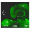 thalamic reticular nucleus
