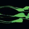 Green Nematodes