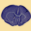 Purple Brain