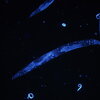 C. Elegans Glowing in the Dark