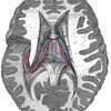 Brain Diagram