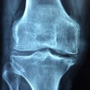 X-Ray Image of a Joint